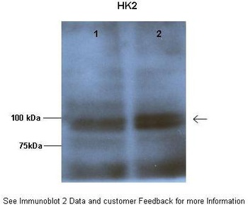 HK2 Antibody