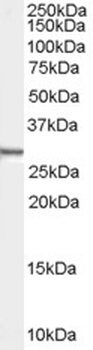 Robo1 Antibody