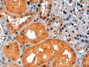 RPS6KB1 Antibody
