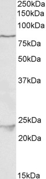KIT/CD117 Antibody