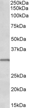 KIT/CD117 Antibody