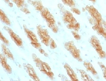 KRT76 Antibody