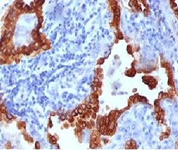 KRT8 Antibody