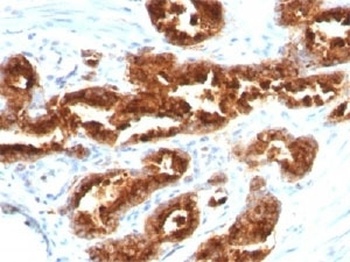 TAG-72 Antibody [B72.3]
