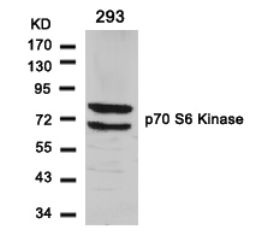 RPS6KB1 Antibody