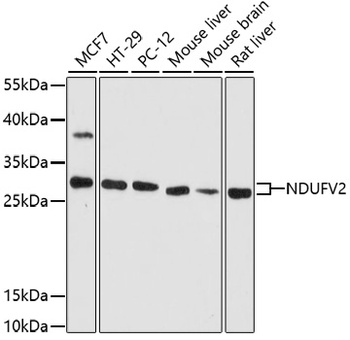 NDUFV2 Antibody