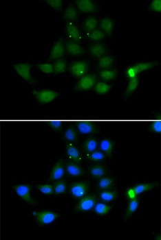 TAT Antibody