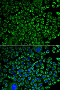 F10 Antibody