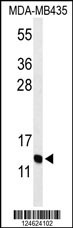 GNRH2 Antibody