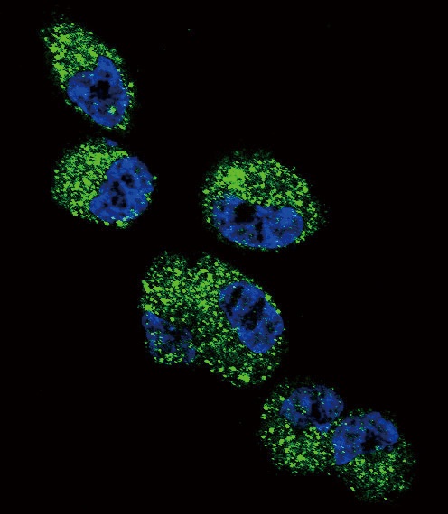 CYP4A11 Antibody