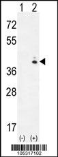 GALK1 Antibody