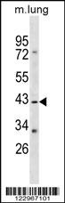 RASSF1 Antibody