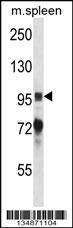 Ptk2b Antibody