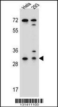 EFNB2 Antibody