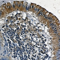VEGFR1 antibody