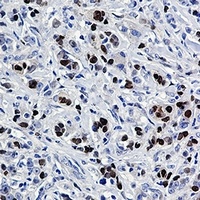 SOX9 Antibody