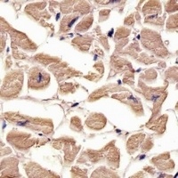 Anti-TUBA1C Antibody