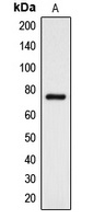 DCLK3 Rabbit Polyclonal Antibody