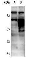 BTK (Phospho-Y223) Antibody