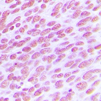 CDC25C antibody