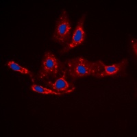 beta-catenin (phospho-S33) antibody
