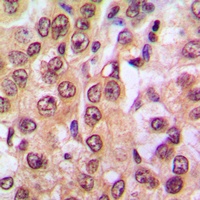 PTEN (pS370) antibody