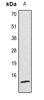 Histone H4 (Acetyl-K12) Antibody