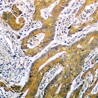 p53 antibody