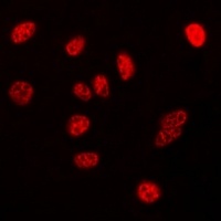 Nucleophosmin antibody