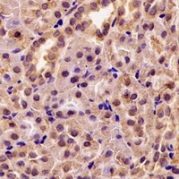 HSPA9 antibody