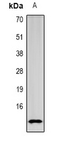 SPINK1 Antibody