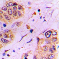 CDC25A (Phospho-S178) antibody