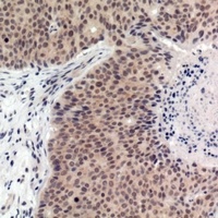 p53 (pT387) antibody