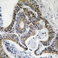 FHIT (pY114) antibody
