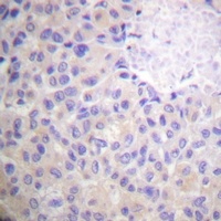 p130 Cas antibody
