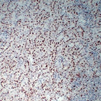 Wilms Tumor 1 Antibody