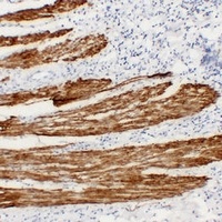 Desmin Antibody