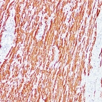 Desmin Antibody