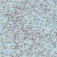 S100-A4 antibody