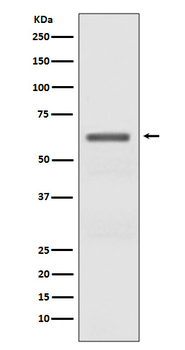 AMPK alpha (Phospho-Thr172) Rabbit mAb