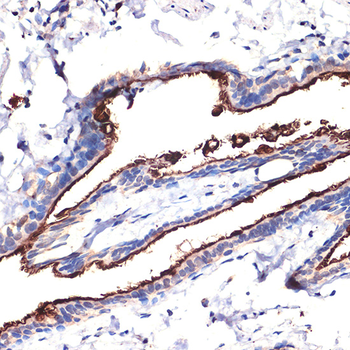 MUC1 antibody