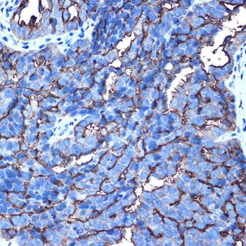 MUC1 antibody