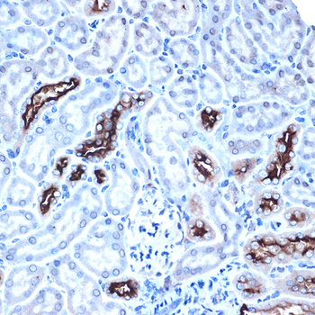 MUC1 antibody