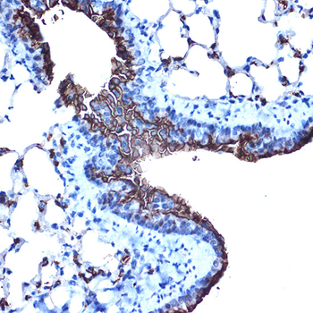 MUC1 antibody