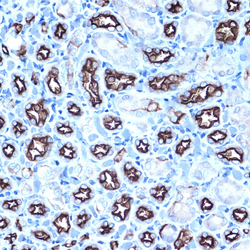 MUC1 antibody