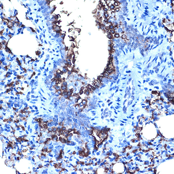 MUC1 antibody