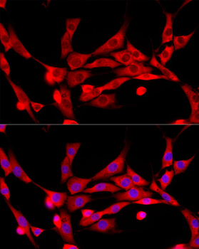 CBL antibody