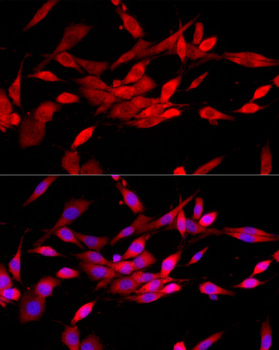 CBL antibody