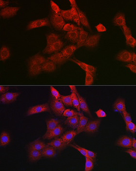 CTSB antibody