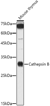 CTSB antibody